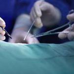 BREAST SURGERY (MAMMOPLASTY) - Journalogi