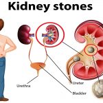Symptoms Of Kidney