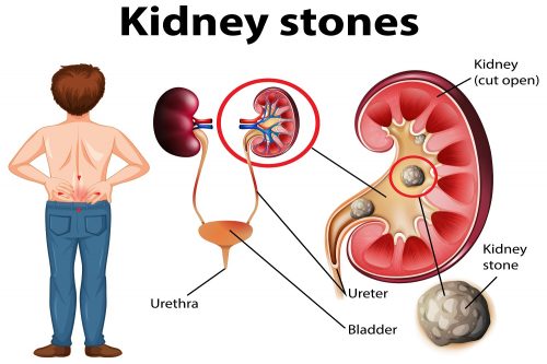 If You Have Kidney Problem, Then Know The Symptoms Of Kidney